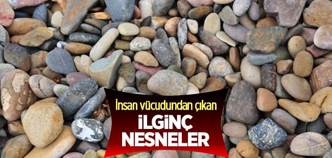 İnsan vücudunda bulunan ilginç nesneler